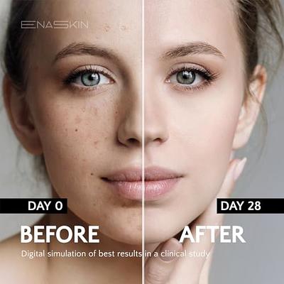  EnaSkin Dark Spot Corrector for Face: Age Spot