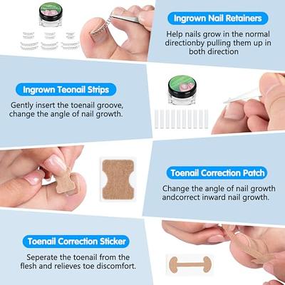 Ingrown Ingrown Toenail Removal Kit, Professional 41 Pcs/Set Ingrown  Toenail Treatment Tool Kit, Ingrown Toenail Corrector and Nail Corrector  Patch