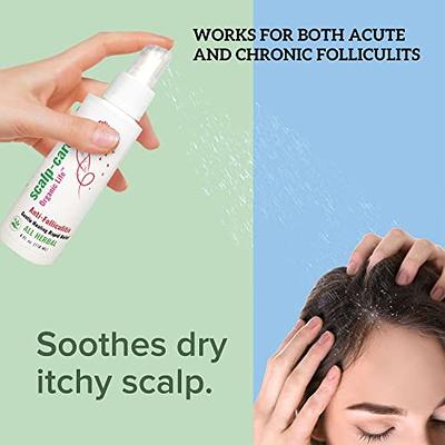 Eczema Honey Soothing Scalp Oil - Natural Hair Oil & Moisturizer Helps Dandruff- Itchy & Dry Scalp Treatment - Daily Hair Care for All Hair & Skin Ty