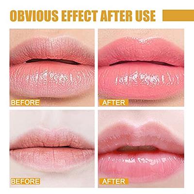 Patchology Lip Service Gloss - to - Balm, Hydrating Lip Treatment with  Aloe, Honey, Vitamin B3, Goji Berry for Dry Cracked Lips Moisturizer (9ml)