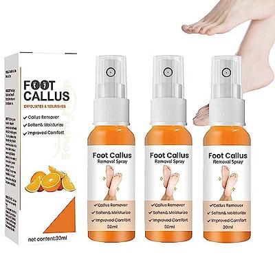 Foot Corn Removal Liquid Painless Callus Remover For Feet Repair Spray Foot  Peeling Spray Orange Oil Feet Instant For Dry Skin - AliExpress