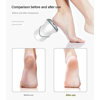 White Electric Foot Grinder, Foot Callus Remover, Dead Skin