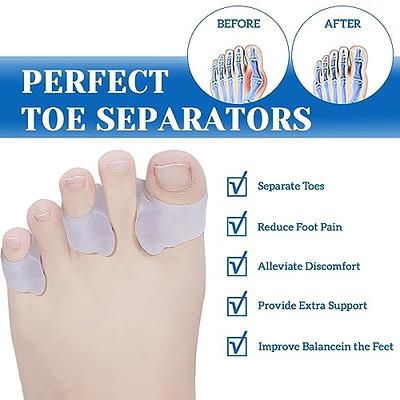 Toe Separators, Spacers, and Correctors for Men and Women - Bunion Pads,  Yoga Toes, Hammer Toe Corrector (Blue)