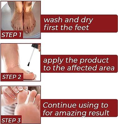 Dr Foot Callus Remover Gel Helps to remove Calluses and Corns 100ml