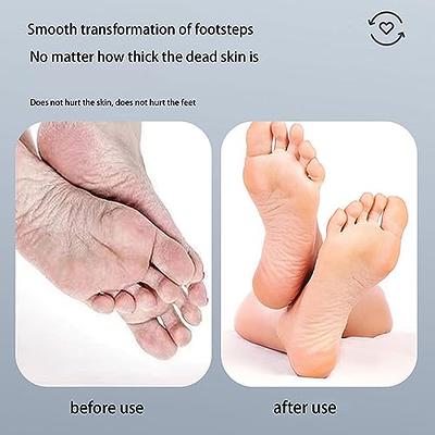 Unique Bargains White Pedicure Feet Care Tool Dead Skin Foot File Removes :  Target