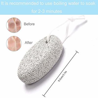 Pumice Stone Foot File, 2 Pack Callus Remover for Feet with Wooden