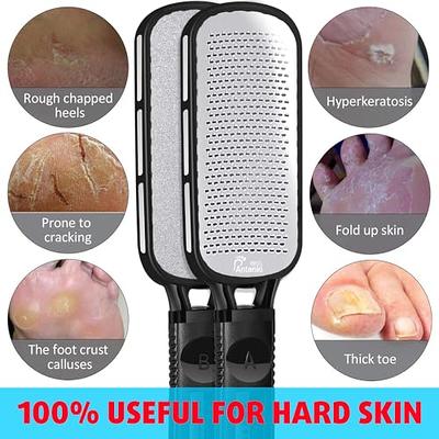 Professional Pedicure Foot File, Foot File Rasp, Callus Remover, Foot  Scrubber - Perfect Foot Care for Cracked Heels - Corn Remover/File -  Pedicure