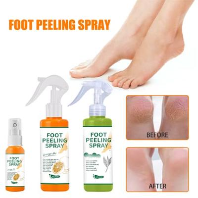 Foot Callus Removal Spray, 30ml Foot Heel Callus Remover Spray, Foot Peel  Spray, Foot Exfoliating Spray - For Quickly Remove Dead Skin And Calluses  On