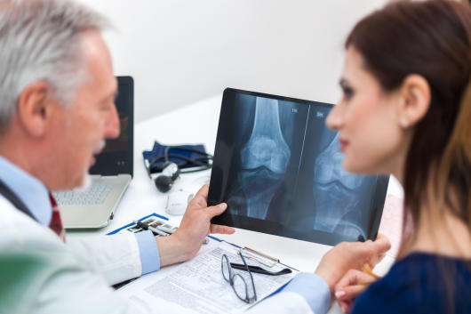 Resultado de imagen de huesos frágiles osteoporosis getty