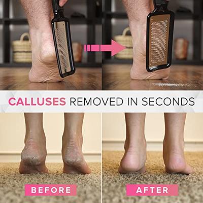 Foot Callus Remover Shaver Heel Hard Dead Skin Remover Scraper