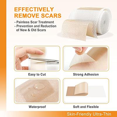 Carbou Silicone Scar Sheets (1.6x 60Roll) Medical Silicone Scar Tape  Roll,Easy-Tear Soft Silicone Tape for Scars Removal,Reusable Painless Silicone  Sheets for Surgery Scars, C-section, Burn, Keloid - Yahoo Shopping