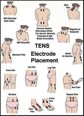 4 Channel TENS Machine (Delta Stim 03)