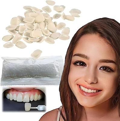 Tooth Repair Kit, Temporary Tooth Replacement Kit, Chipped Tooth Repair Kit  for Missing & Broken Teeth, with Mouth Mirror, Tartar Scraper, Dental  Probe, Regain Confidence Smile - Yahoo Shopping