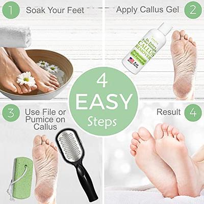 Dermasuri Callus Remover Foot Scrub - Exfoliating Feet Spray-on Formula and  Reusable Deluxe Foot File - Dead Skin Remover, Callus Rasp, Scrubber, Peel