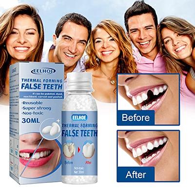 Tooth Solid Gel Temporary Moldable Repair Kit Thermal Fitting Bead Teeth  30ml