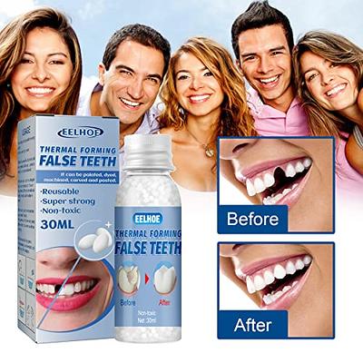 Moldable False Teeth  Temporary Tooth Repair Kit For Filling The