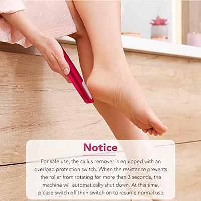 Rechargeable Electric Callus Remover Tool For An At-Home Spa Pedicure  Experience - Removes Dry Skin 