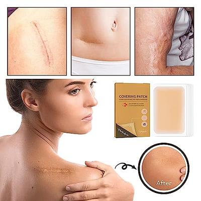 Ultra-Thin Waterproof Tattoo Cover Up Tape for Perfect Coverage | Set of 6  Pcs