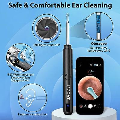  Ear Wax Removal, Ear Wax Removal Tool with 1296P HD
