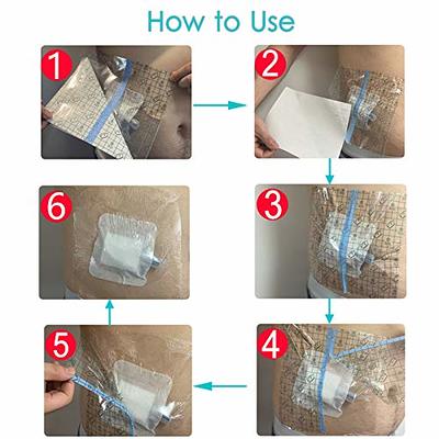 50 Pcs Chest Port Shower Cover Waterproof Adhesive Bandage Protector 4 x 4  Inch for Dialysis Catheter Chemo Hemodialysis Transparent Patch Surgery