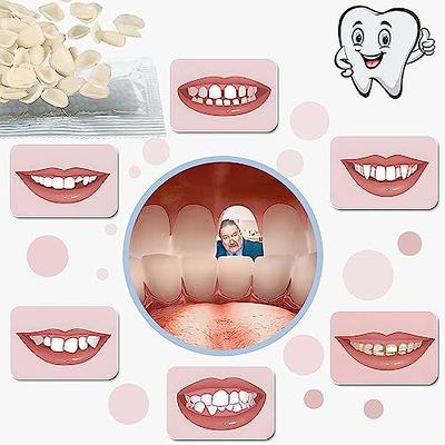 VEZE Tooth Repair Kit-Thermal Fitting Beads Granules and Fake Teeth for  Temporary Fixing Missing and Broken Tooth, Moldable Fake Teeth and Thermal  Beads Replacement Kit.【Teeth - Piece Yellow】 - Yahoo Shopping