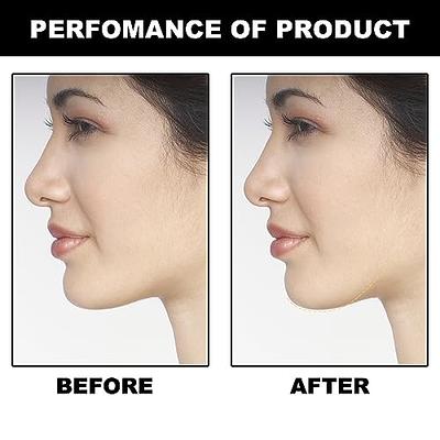 3PCS Premium Facial Exerciser - Jawline Trainer 3 Resistance Levels Tighten  Tone & Strengthen jawline, chin, lips