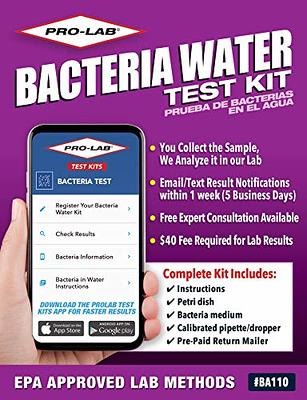 ProLab Mold Test Kit For Home For Air And Surface Testing - Mold Test Kit  Includes Expert Consultation Pre-Paid Return Mailer Emailed Mold Report $40  Fee Required For AIHA Lab Analysis. (MO109)