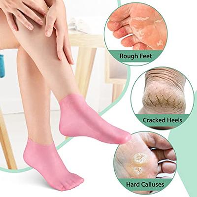 Scholl Foot Hard Skin & Callus Creams Deodorant Remover Tool or