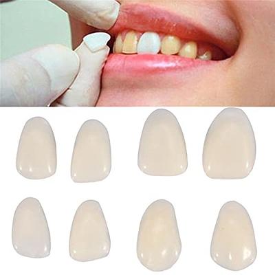 Temporary Tooth Repair Kit for Temporary Fixing Missing and Broken Tooth Moldable Fake Teeth and Thermal Beads Replacement Kit (Size : 1)