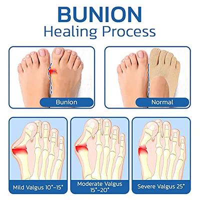 Doctor's Select Bunion Relief Socks 2 Pairs - Bunion Socks for Women and  Men