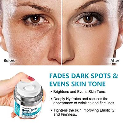 Dark Spot Remover for Face and Body, Dark Spot Corrector for Face, Sun Spots  Melasma Cream and Freckle Remover- Formulated with Arbutin, Niacinamide &  Vitamin E