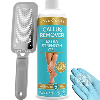 Callusfune - The Foot Callus Remover, Pedicure Wand for Feet Electric