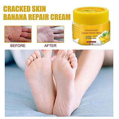 Exfoliating Scrub Gel, Face Hand Feet Dead Skin Remover Moisturizing  Smoothing for Thick Cracked Rough Dry Skin for Hand Foot Face and Full Body  Care