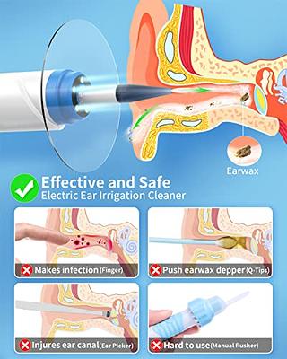 Ear Wax Removal Tools Kit Ear Irrigation Flushing Earwax - Temu