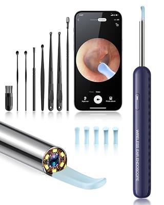 Ear Wax Removal, Ear Cleaner Camera with 1080P, Ear Cleaning Kit with 6 Ear  Pick, Ear Camera for iPhone, iPad, Android Phones, with 8 Pcs Ear Set  (Blue) - Yahoo Shopping