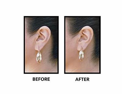  Lobe Wonder - The ORIGINAL Ear Lobe Support Patch for Pierced  Ears - Eliminates the Look of Torn or Stretched Piercings - Protects  Healthy Ear Lobes from Tearing - 120 Patches 