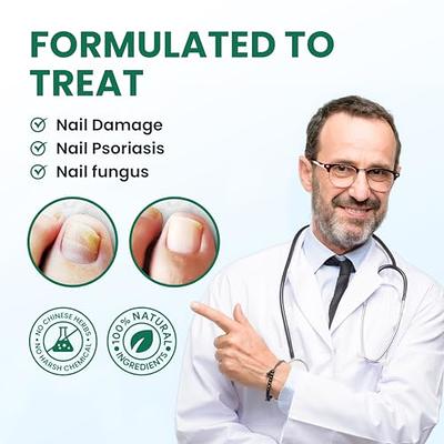 Toenail Fungus Treatment Extra Strength - Best nail fungus treatment for  fingernails, nail repair, toenail softener, yellow toenail treatment,  ingrown nail and foot fungus treatment extra strength - Yahoo Shopping