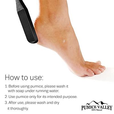 Foot File Foot Scrubber Pedicure - Callus Remover for Feet Grater Rasp Foot  Scraper Corns Callous Removers Dry skin Cracked Dead Skin Remover for Dry  and Wet Feet 