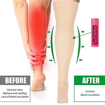 Compression Socks Thigh High Stockings Men Women 20-30 mmHg Varicose Veins  Edema