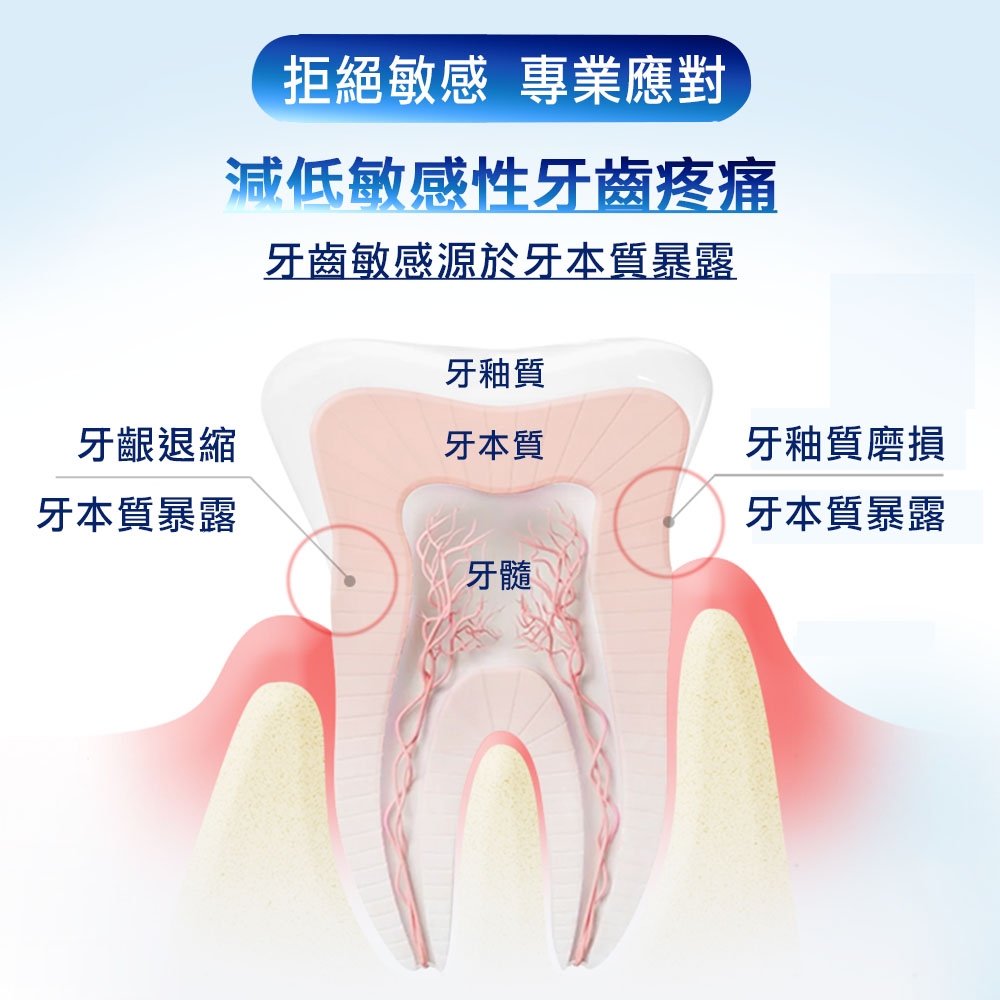 西班牙Foramen 酸冷敏感修復牙膏75ml/90g