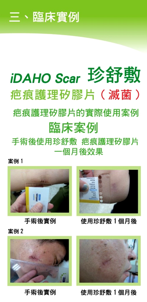 iDAHO珍舒敷 疤痕護理矽膠片(5X30cm)-1片