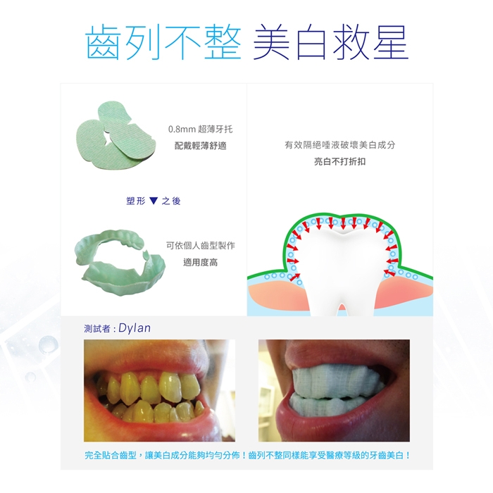 Protis普麗斯 新3D牙托式深層長效組 7-9天