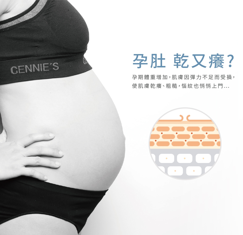 Gennies奇妮-Perfect Skin 孕美肌撫紋基礎組(肚膜+撫紋霜)