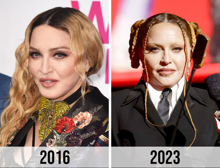 Madonna Looks 'Unrecognizable' Now, A Plastic Surgeon Weighs In