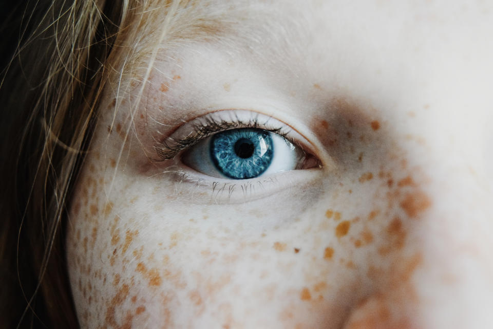 Eye colour is inherited but it's complicated [Photo: Getty]