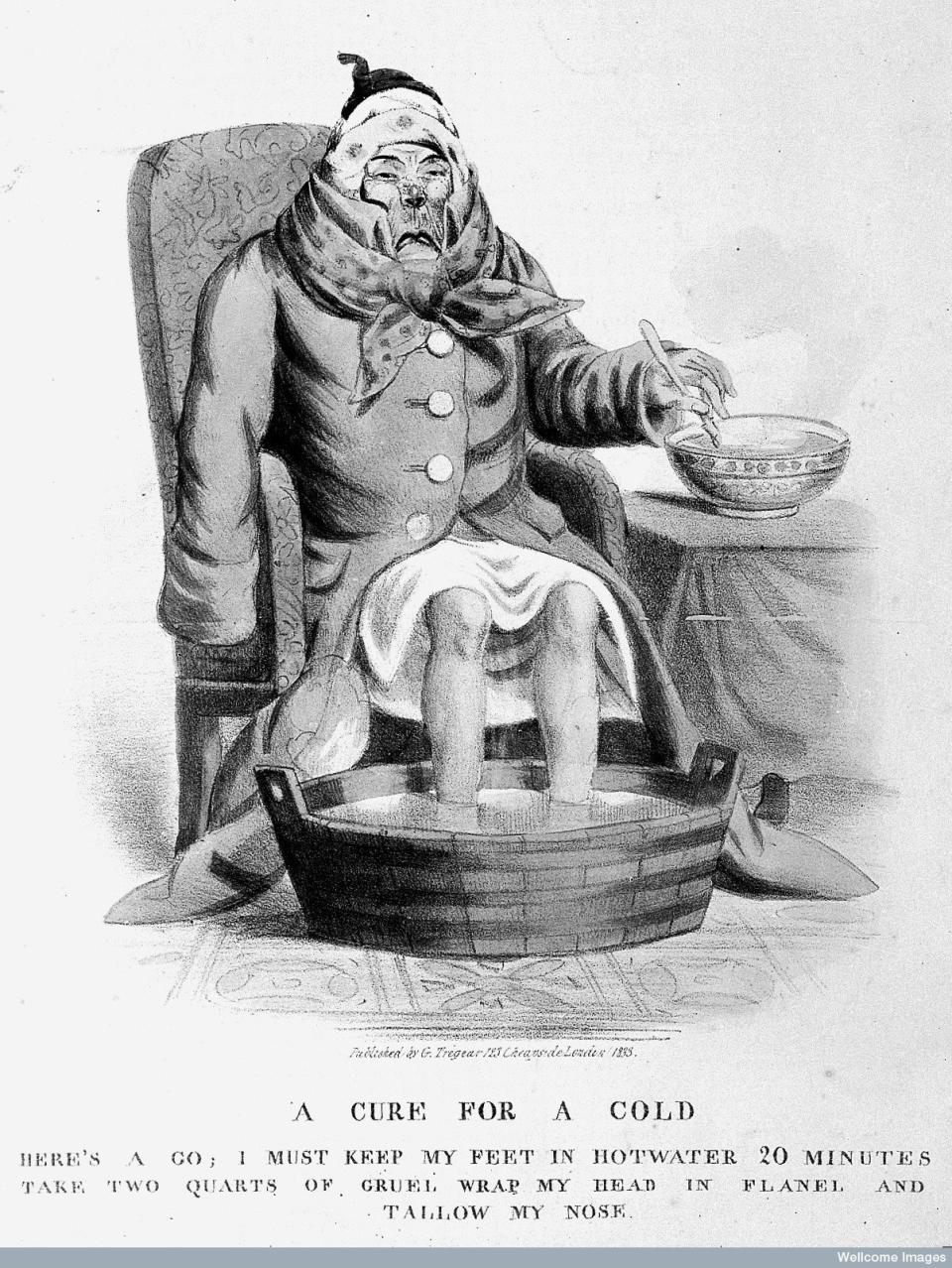 A sick man with a cold. Colored lithograph, 1833.