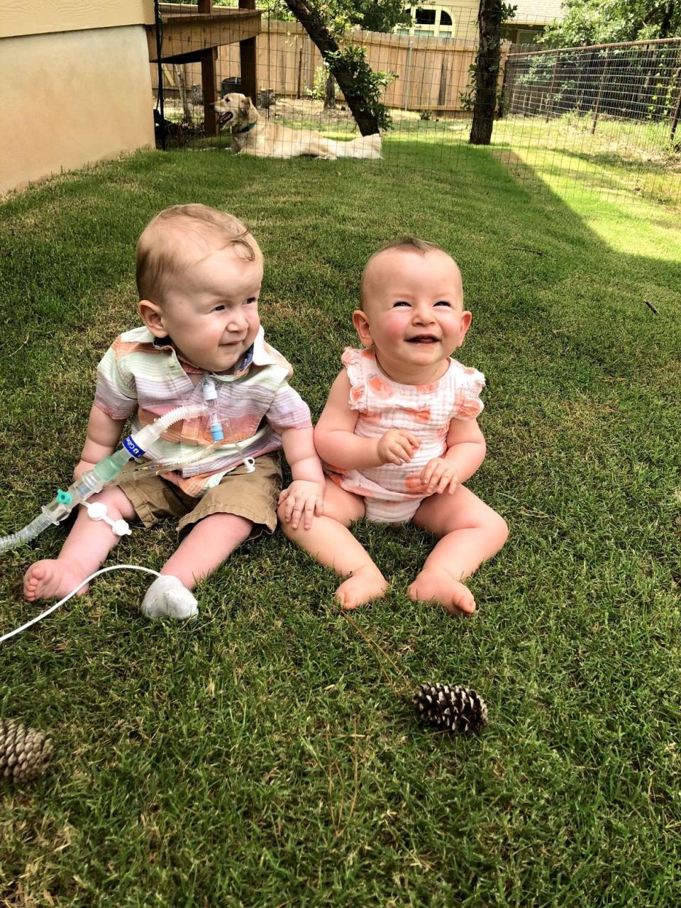 Gray Carter had to be put on a ventilator as a baby because of the progression of SMA. His twin sister Adelaide also has the disease but didn't need a ventilator.