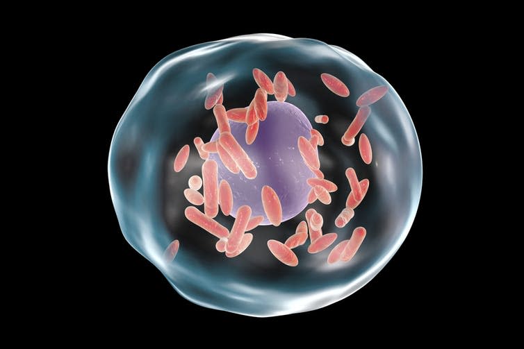 <span class="caption">Artist’s impression of Coxiella burnetii bacteria (small red shapes) inside a human cell.</span> <span class="attribution"><a class="link " href="https://www.shutterstock.com/download/confirm/420181576?src=HyacTPxbIoeD6RMGG5B4cQ-1-4&size=medium_jpg" rel="nofollow noopener" target="_blank" data-ylk="slk:Kateryna Kon/Shutterstock;elm:context_link;itc:0;sec:content-canvas">Kateryna Kon/Shutterstock</a></span>