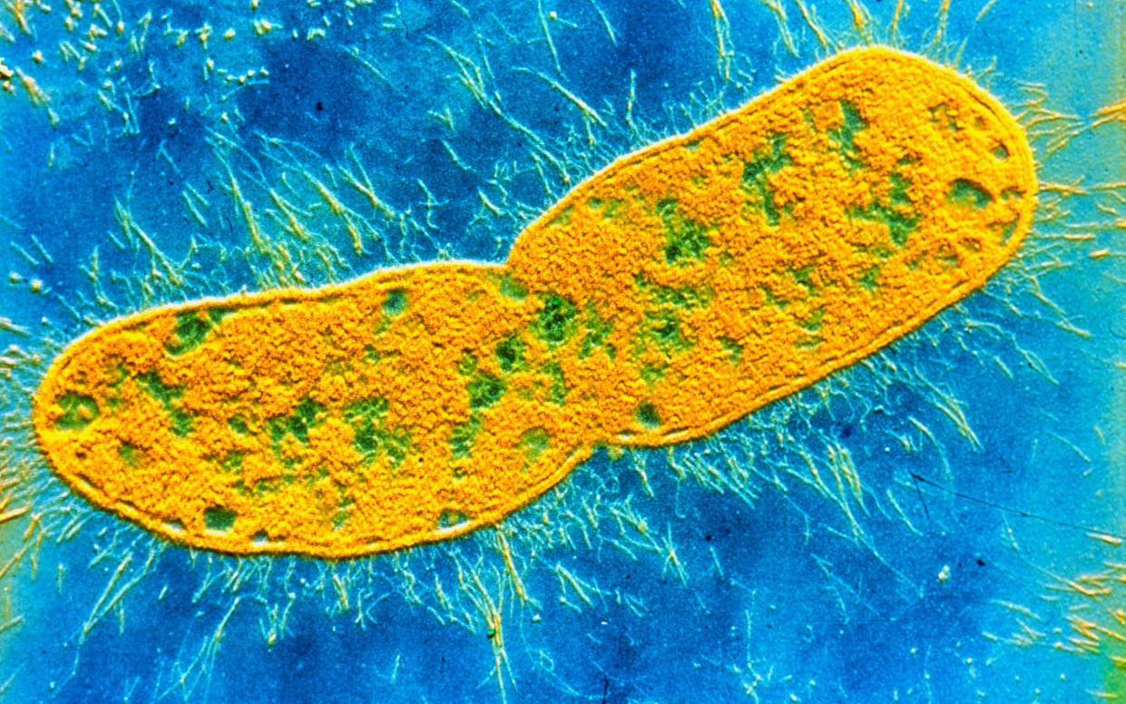 False colour transmission electron micrograph (shadow technique) of Klebsiella pneumoniae, a rodlike bacterium associated with pneumonia & other respiratory infections in humans