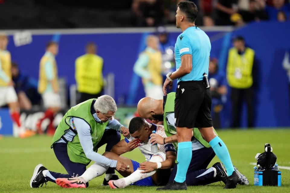 Kylian Mbappe's broken nose. <i>(Image: PA Images)</i>